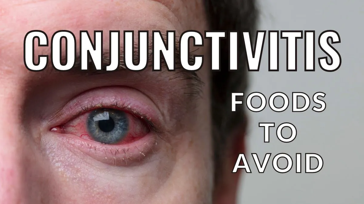Conjunctivitis: Foods to Avoid