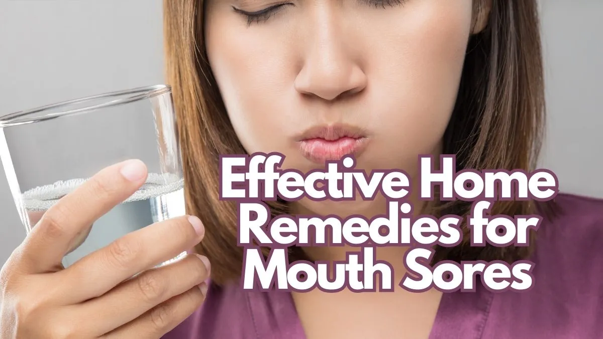 Home Remedies for Mouth Sores