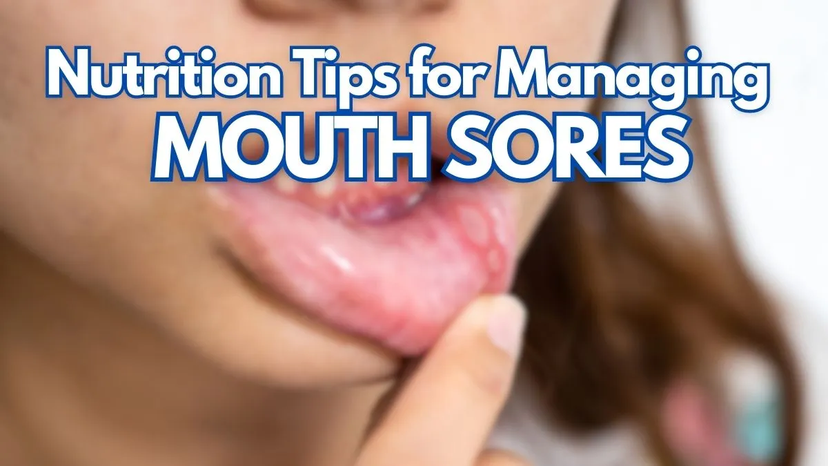 Nutrition Tips for Managing Mouth Sores