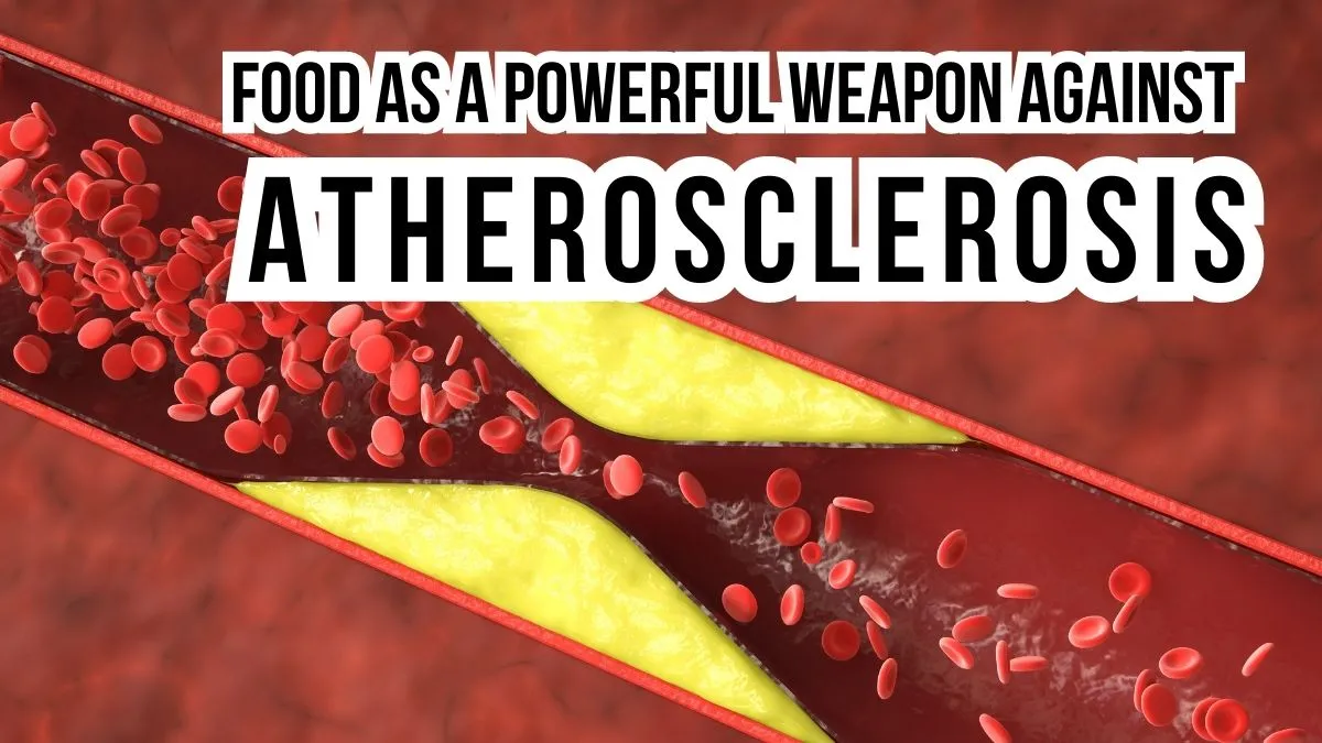 Foods for Atherosclerosis