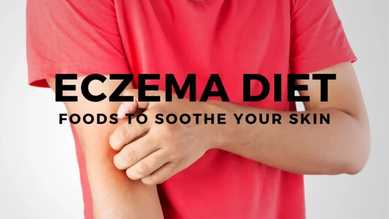 Eczema Diet: Foods to Soothe Your Skin
